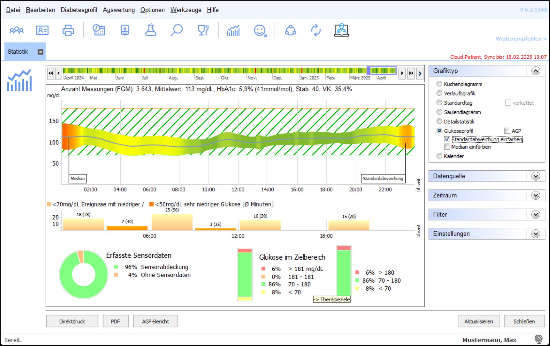 SiDiary-Statistik mit Glukoseprofil