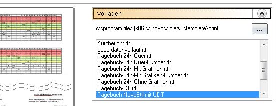 UDT-Ausdruck w&auml;hlen